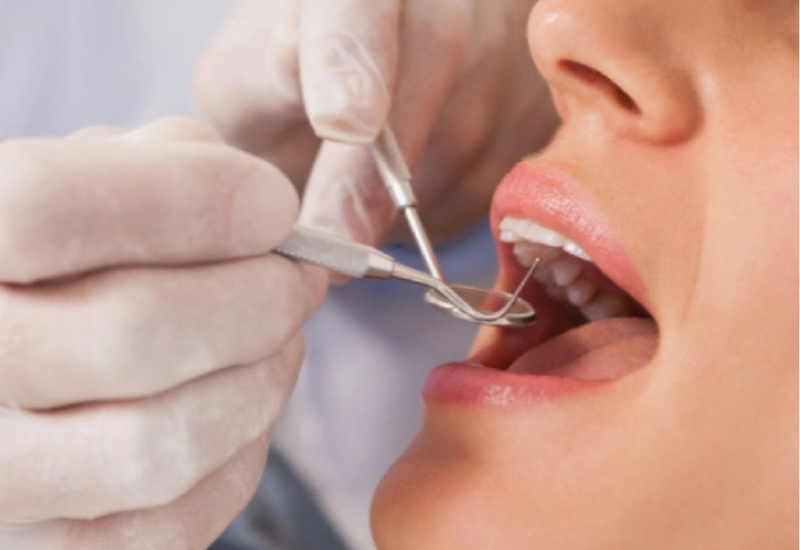 O que acontece se um dente cariado não for tratado?