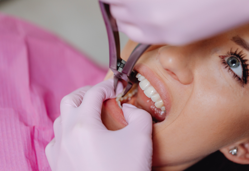 Por que a prevenção odontológica evita tratamentos mais complexos